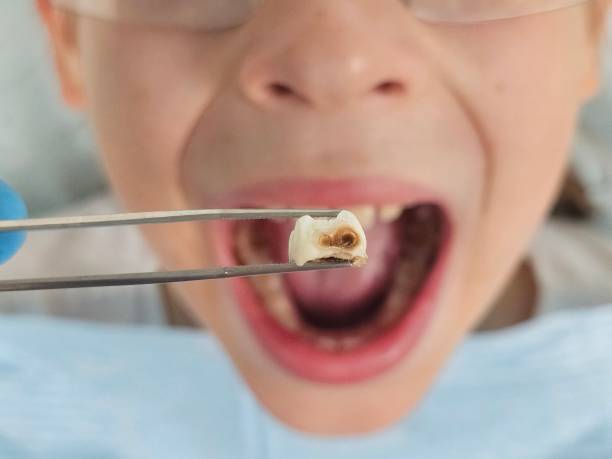 Best Weekend Emergency Dental Services in Gordon, PA